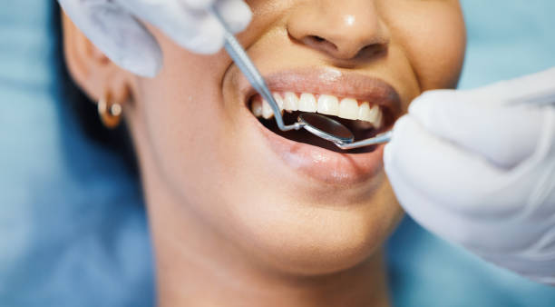 Best Emergency Gum Treatment in Woodburn, IN
